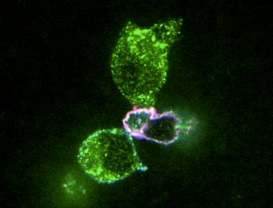 Engineered primary human CD8+ T cell (red) targeting lymphoma cells (green)